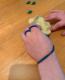 Functional Hand Splints: An Easy DIY 3